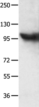 MCM8 Antibody