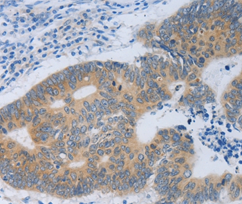 MT2A Antibody