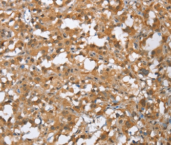 MMP12 Antibody