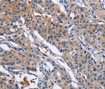 MMP16 Antibody