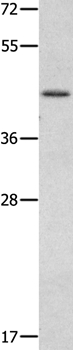 MMP28 Antibody