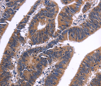 NFATC3 Antibody