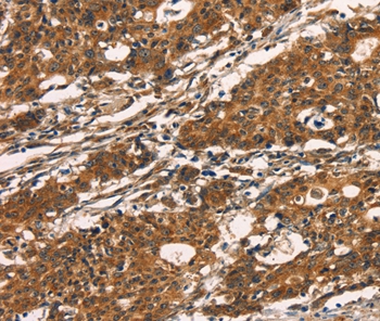 KLRC1 Antibody