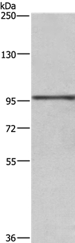 RB1 Antibody