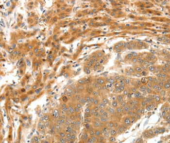 SERPINE1 Antibody