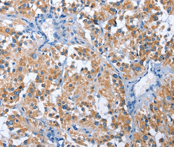PAK6 Antibody