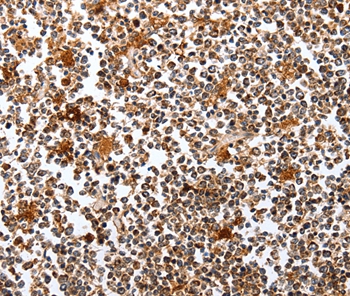 PIK3R1 Antibody