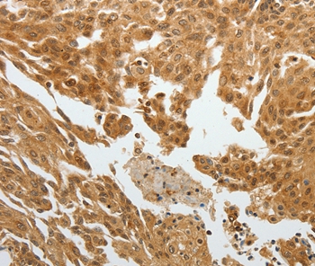 RETNLB Antibody