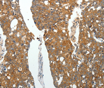 ROCK1 Antibody