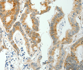 SELM Antibody