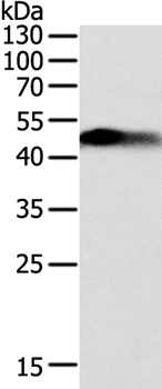 SLC12A1 Antibody