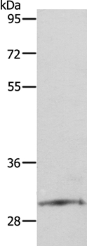 SNAI2 Antibody