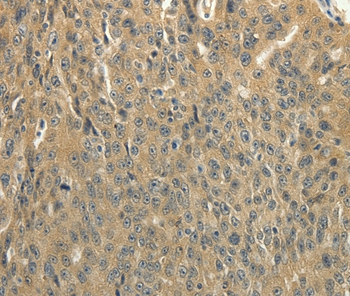 SOCS5 Antibody
