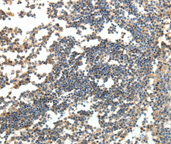 SPAG8 Antibody