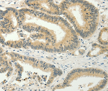 SPIN4 Antibody