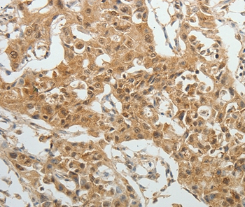 SYT6 Antibody
