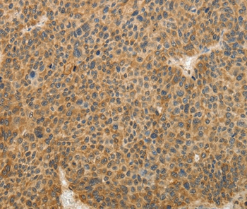 TFPI2 Antibody
