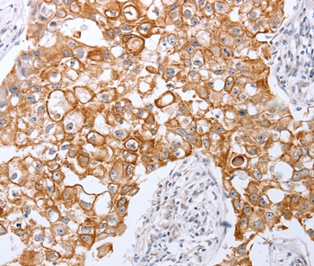 TNFAIP1 Antibody