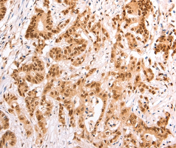 TAX1BP1 Antibody