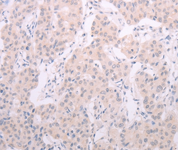 TSHR Antibody