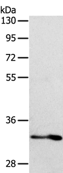 IL1RL1 Antibody