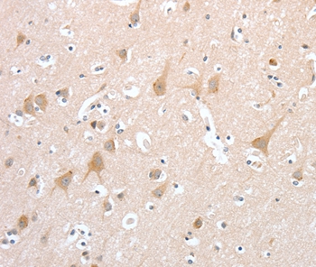 PCDHB16 Antibody