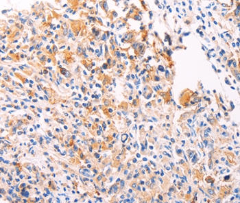 PGBD1 Antibody