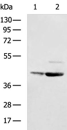 NCEH1 Antibody