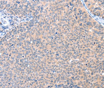 AADACL2 Antibody