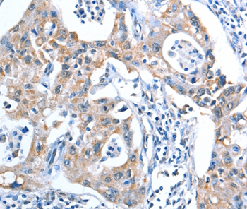 ADSL Antibody