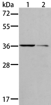 AKR1B10 Antibody