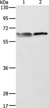 ALAS2 Antibody
