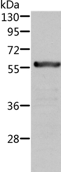 ALDH6A1 Antibody