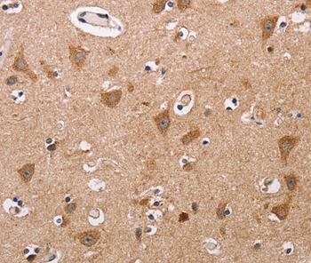 ALG9 Antibody