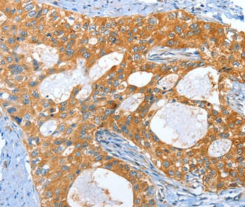 AMHR2 Antibody