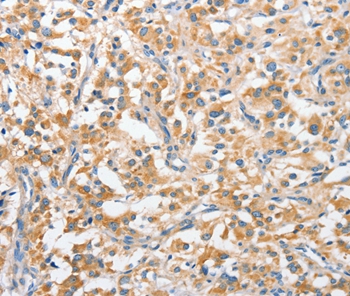 ANKMY2 Antibody