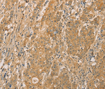 SNAP91 Antibody