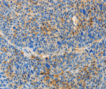TNFSF13 Antibody