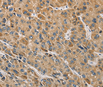 MIP Antibody