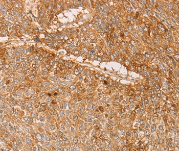 PACSIN2 Antibody