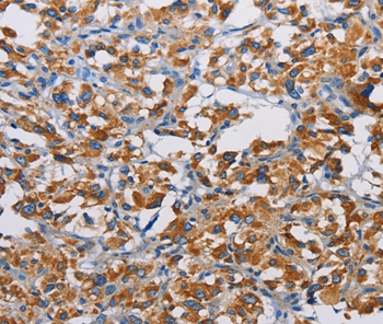 TSPEAR Antibody