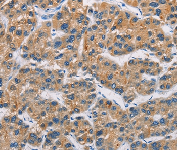 CERK Antibody