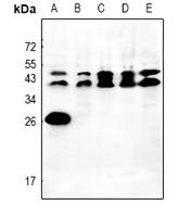 ORM2 Antibody