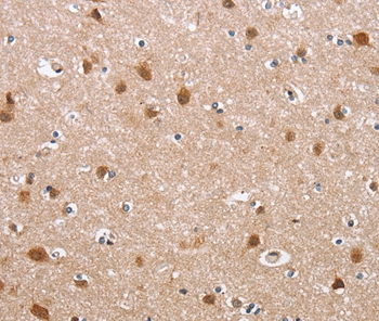 DEFA6 Antibody
