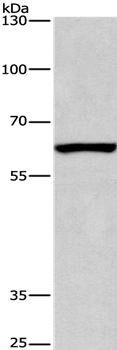 ARMCX2 Antibody