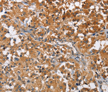 ATP1B2 Antibody