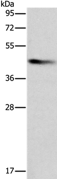 BCAT1 Antibody