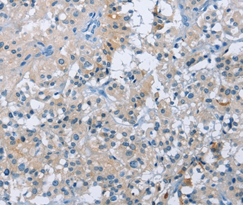 BTN2A2 Antibody