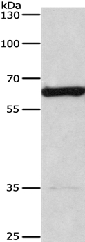 CACNB1 Antibody