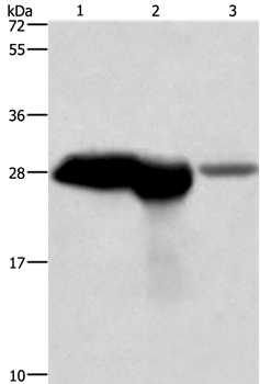 CALB1 Antibody